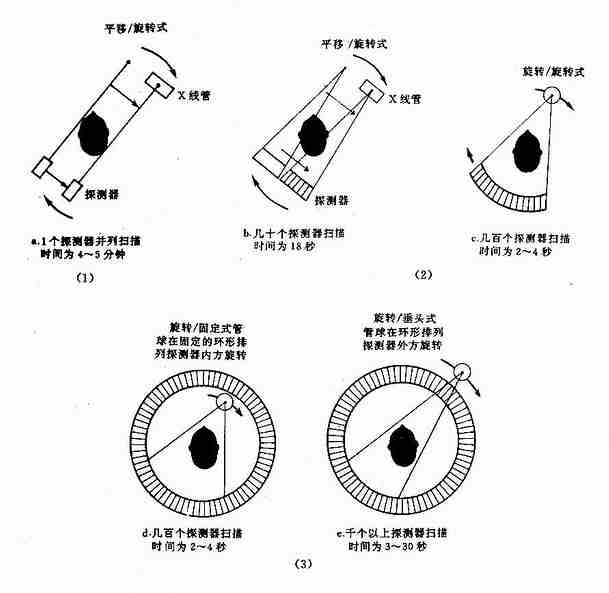 ct扫描是什么原理_ct扫描是穿刺吗