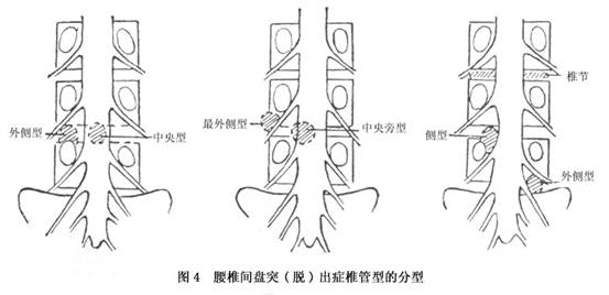 Gyr87i4n.jpg